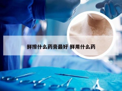 鲜擦什么药膏最好 鲜用什么药