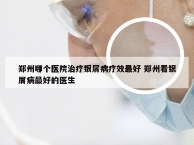 郑州哪个医院治疗银屑病疗效最好 郑州看银屑病最好的医生