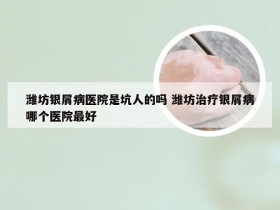 潍坊银屑病医院是坑人的吗 潍坊治疗银屑病哪个医院最好