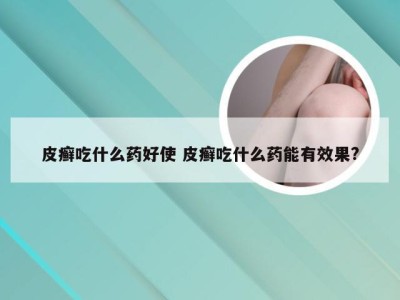 皮癣吃什么药好使 皮癣吃什么药能有效果?