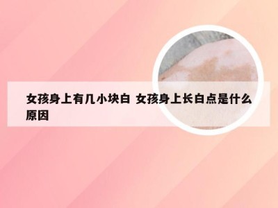 女孩身上有几小块白 女孩身上长白点是什么原因