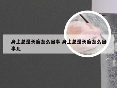 身上总是长癣怎么回事 身上总是长癣怎么回事儿