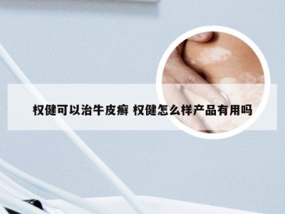 权健可以治牛皮癣 权健怎么样产品有用吗