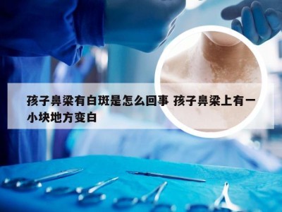 孩子鼻梁有白斑是怎么回事 孩子鼻梁上有一小块地方变白