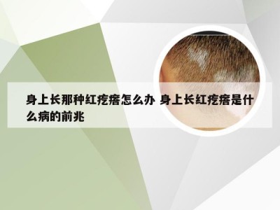 身上长那种红疙瘩怎么办 身上长红疙瘩是什么病的前兆