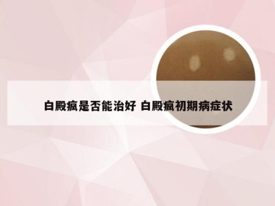 白殿疯是否能治好 白殿疯初期病症状