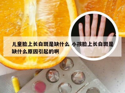 儿童脸上长白斑是缺什么 小孩脸上长白斑是缺什么原因引起的啊