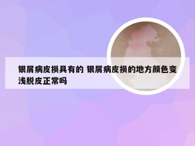 银屑病皮损具有的 银屑病皮损的地方颜色变浅脱皮正常吗