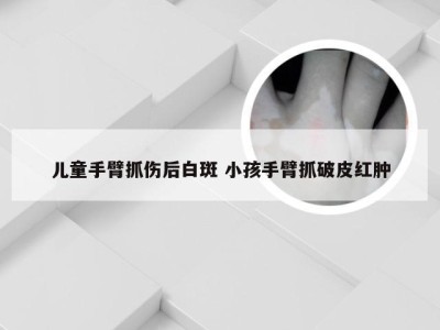 儿童手臂抓伤后白斑 小孩手臂抓破皮红肿