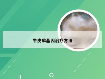 牛皮癣基因治疗方法