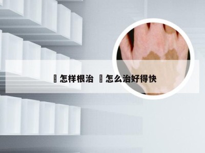 廯怎样根治 齁怎么治好得快