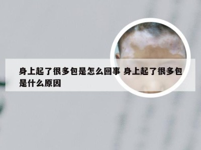 身上起了很多包是怎么回事 身上起了很多包是什么原因