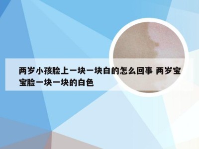 两岁小孩脸上一块一块白的怎么回事 两岁宝宝脸一块一块的白色