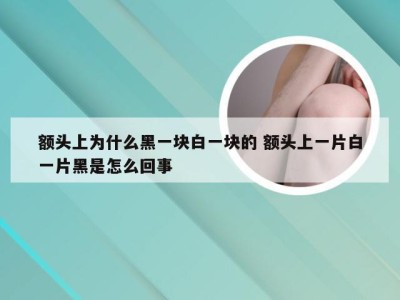 额头上为什么黑一块白一块的 额头上一片白一片黑是怎么回事