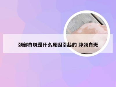 颈部白斑是什么原因引起的 脖颈白斑