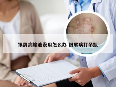 银屑病输液没用怎么办 银屑病打吊瓶