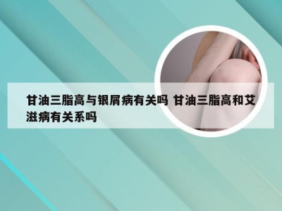 甘油三脂高与银屑病有关吗 甘油三脂高和艾滋病有关系吗