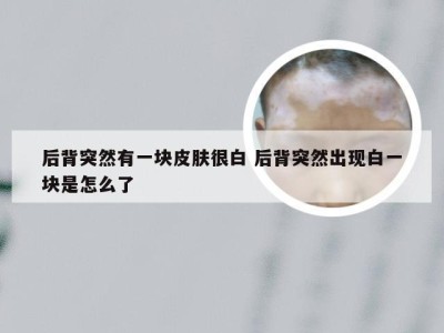 后背突然有一块皮肤很白 后背突然出现白一块是怎么了