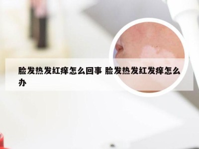 脸发热发红痒怎么回事 脸发热发红发痒怎么办