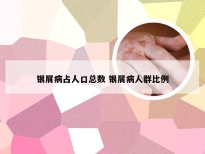 银屑病占人口总数 银屑病人群比例