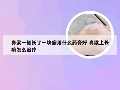 鼻梁一侧长了一块癣用什么药膏好 鼻梁上长癣怎么治疗