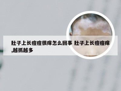 肚子上长痘痘很痒怎么回事 肚子上长痘痘痒,越抓越多