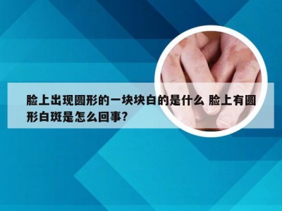 脸上出现圆形的一块块白的是什么 脸上有圆形白斑是怎么回事?