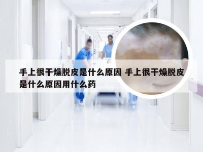 手上很干燥脱皮是什么原因 手上很干燥脱皮是什么原因用什么药