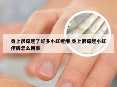 身上很痒起了好多小红疙瘩 身上很痒起小红疙瘩怎么回事