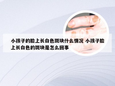 小孩子的脸上长白色斑块什么情况 小孩子脸上长白色的斑块是怎么回事