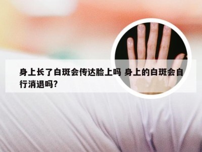 身上长了白斑会传达脸上吗 身上的白斑会自行消退吗?