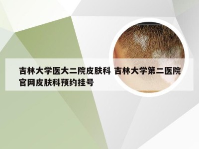 吉林大学医大二院皮肤科 吉林大学第二医院官网皮肤科预约挂号