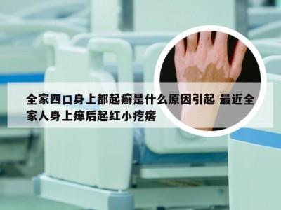 全家四口身上都起癣是什么原因引起 最近全家人身上痒后起红小疙瘩