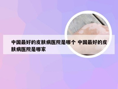 中国最好的皮肤病医院是哪个 中国最好的皮肤病医院是哪家