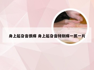 身上起旮沓很痒 身上起旮沓特别痒一抓一片