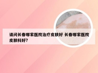 请问长春哪家医院治疗皮肤好 长春哪家医院皮肤科好?