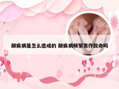 颠疯病是怎么造成的 颠疯病频繁发作致命吗