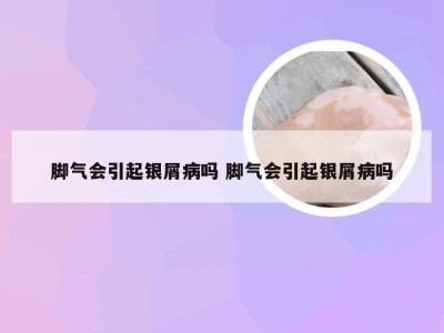 脚气会引起银屑病吗 脚气会引起银屑病吗