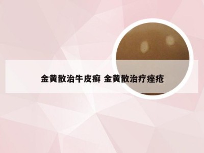 金黄散治牛皮癣 金黄散治疗痤疮