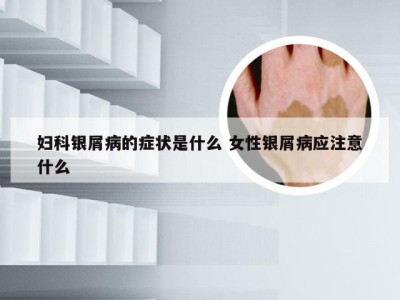 妇科银屑病的症状是什么 女性银屑病应注意什么