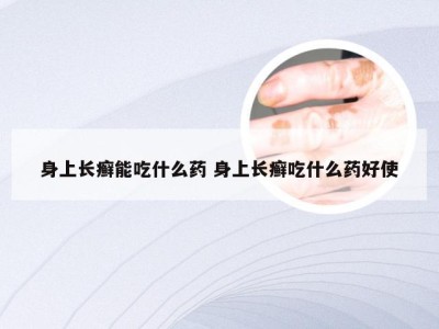 身上长癣能吃什么药 身上长癣吃什么药好使