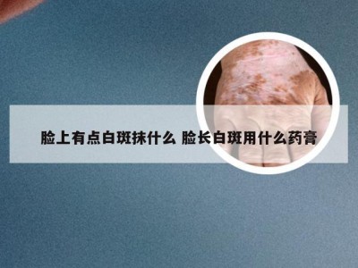 脸上有点白斑抹什么 脸长白斑用什么药膏