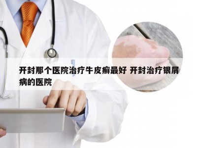 开封那个医院治疗牛皮癣最好 开封治疗银屑病的医院