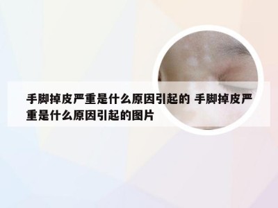 手脚掉皮严重是什么原因引起的 手脚掉皮严重是什么原因引起的图片