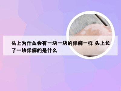 头上为什么会有一块一块的像癣一样 头上长了一块像癣的是什么