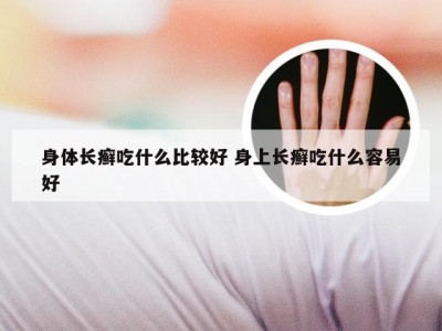 身体长癣吃什么比较好 身上长癣吃什么容易好