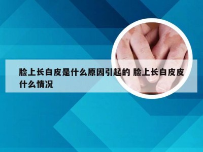 脸上长白皮是什么原因引起的 脸上长白皮皮什么情况