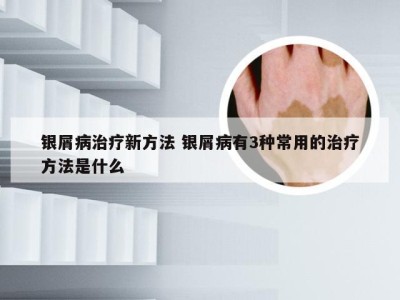 银屑病治疗新方法 银屑病有3种常用的治疗方法是什么