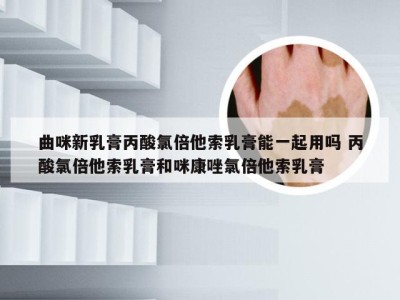 曲咪新乳膏丙酸氯倍他索乳膏能一起用吗 丙酸氯倍他索乳膏和咪康唑氯倍他索乳膏