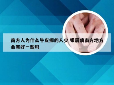 南方人为什么牛皮癣的人少 银屑病南方地方会有好一些吗